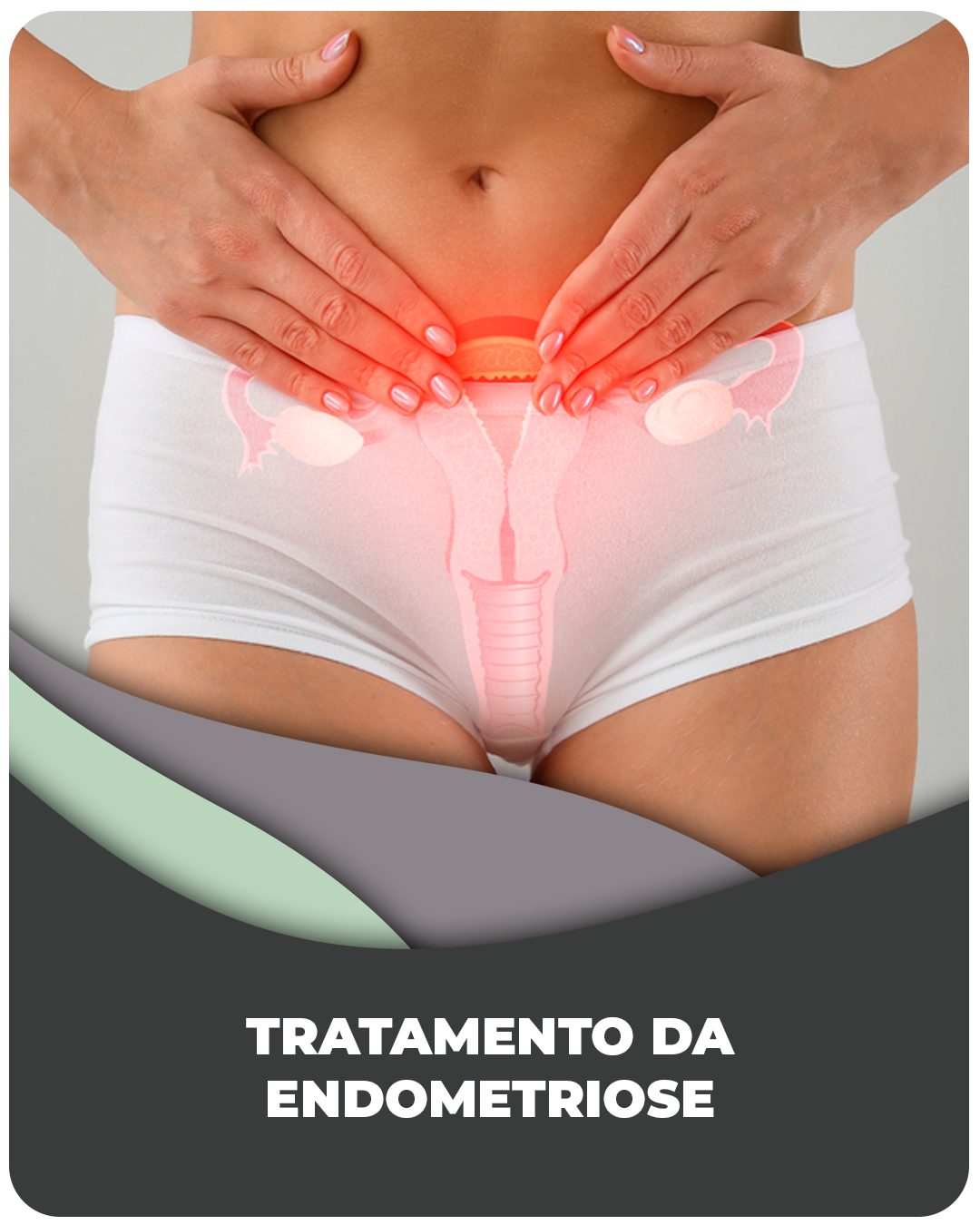 Tratamento da Endometriose